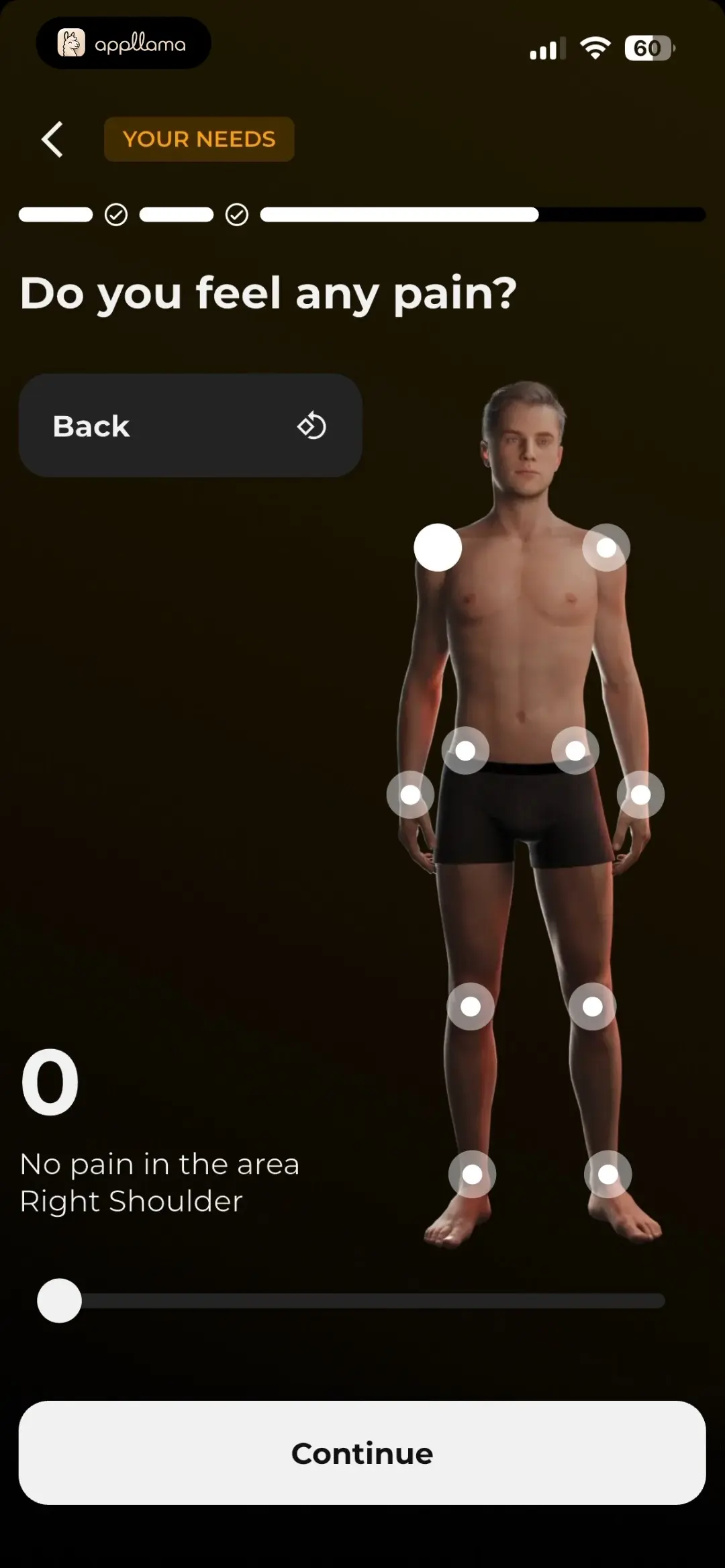 Pain Assessment