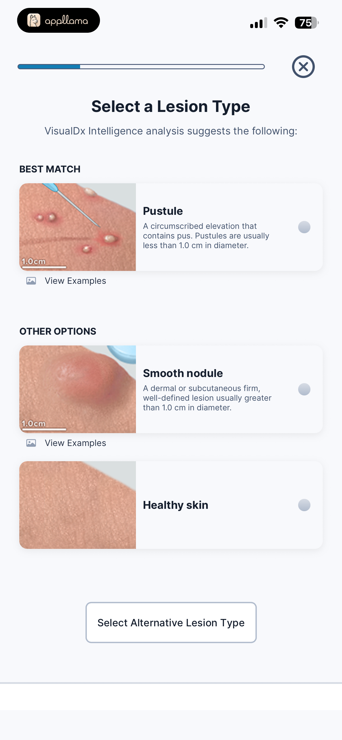 Select Lesion Type