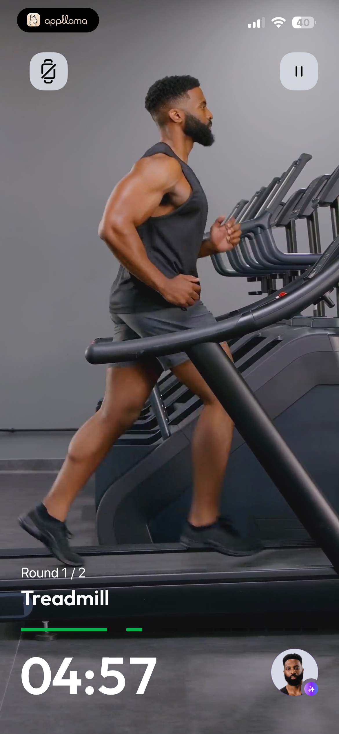 Treadmill Exercise