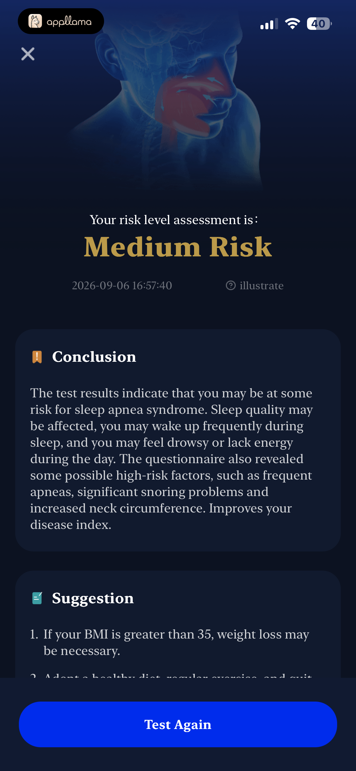 Sleep Apnea Risk Result