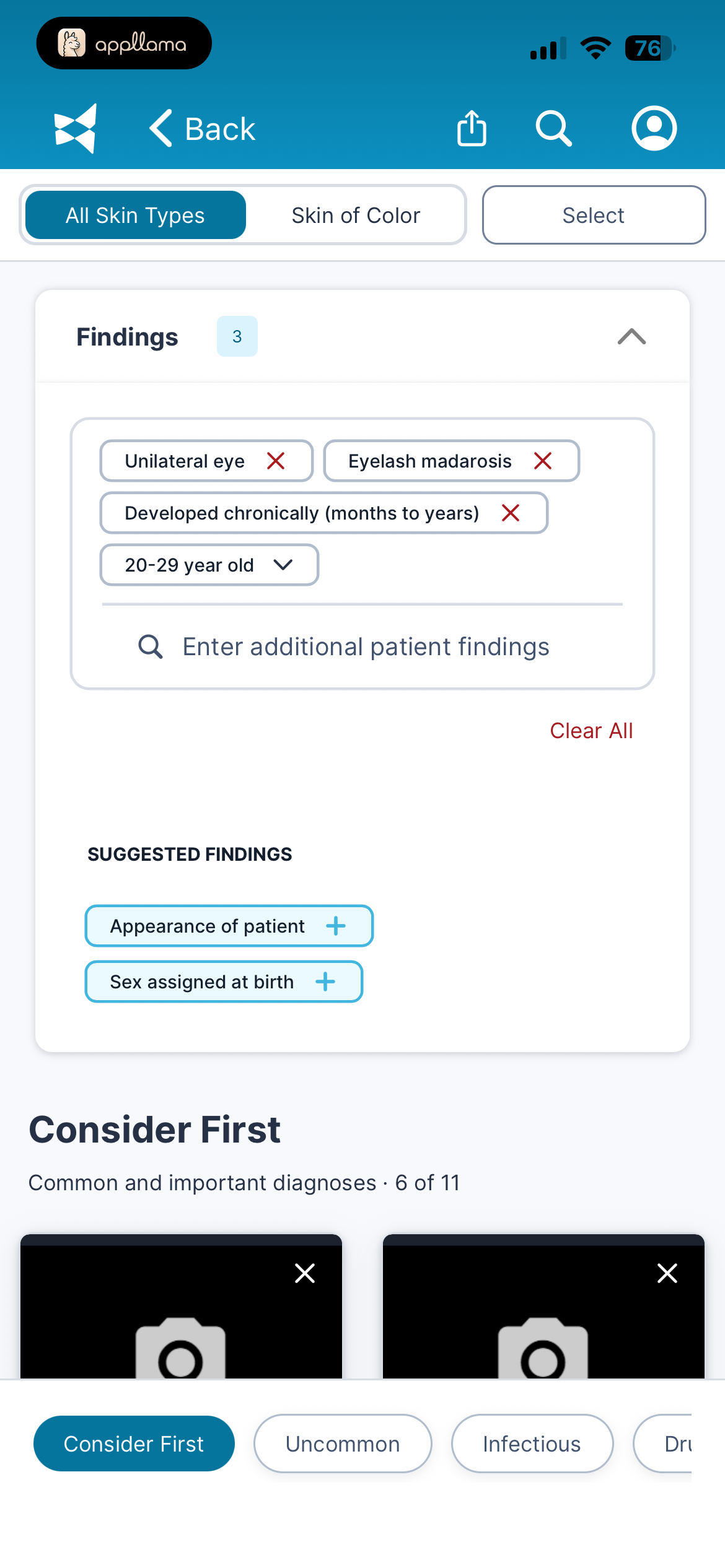 Findings Filters