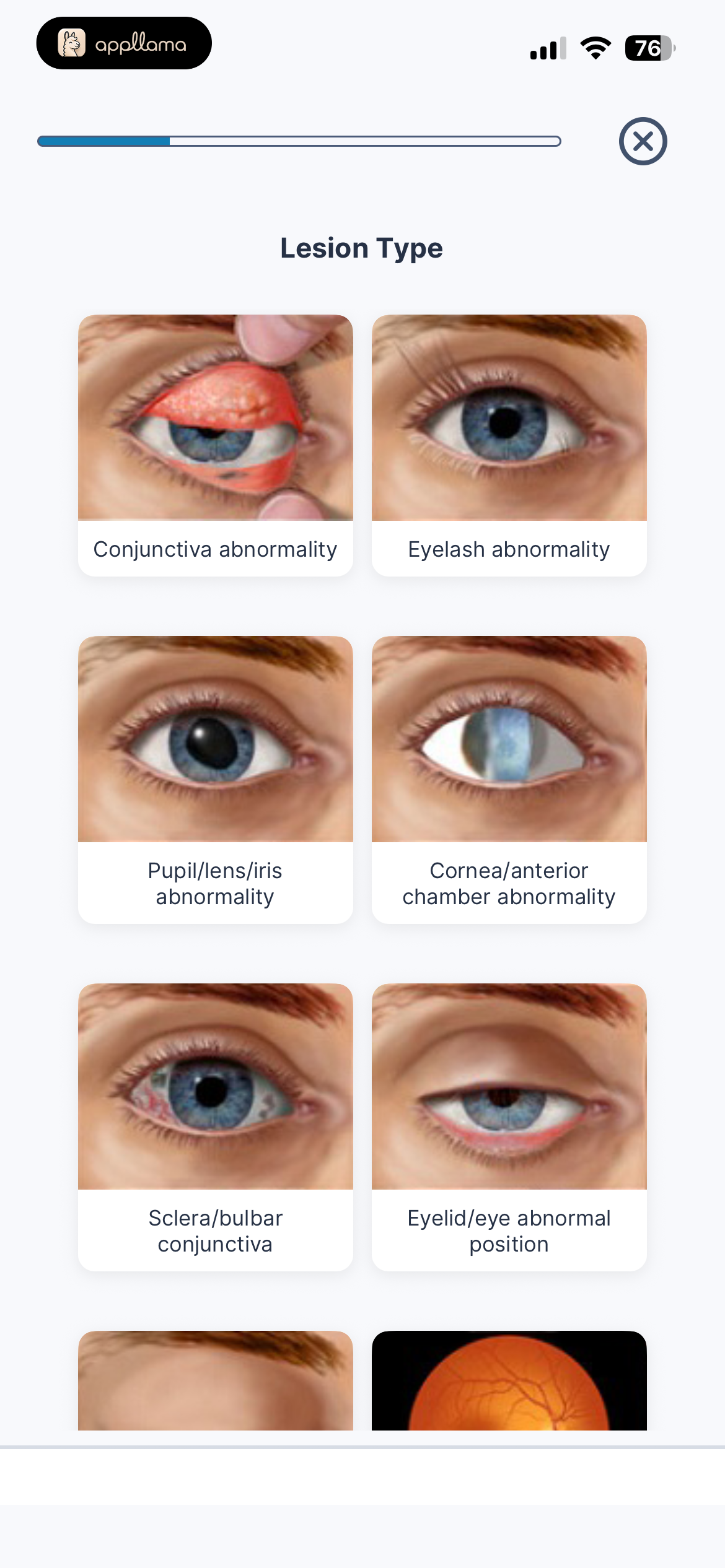 Lesion Type Picker